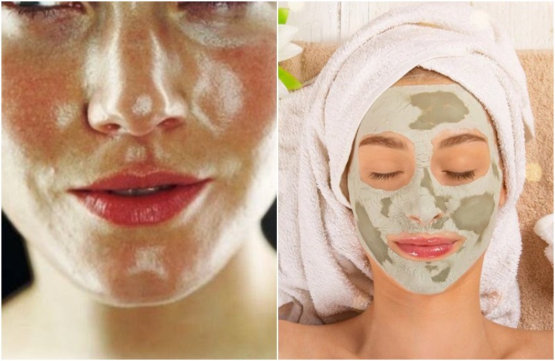 5 Effective Ways For Fighting Oily Skin in Summers