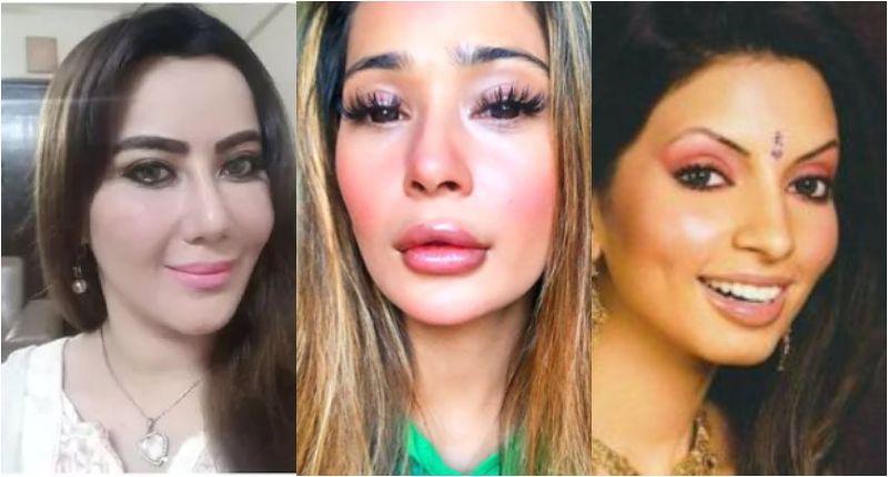 4 TV Actresses Before and After Rumored Plastic Surgery