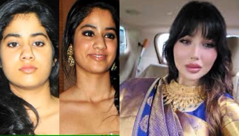 5 Popular Bollywood Actresses Trolled For Plastic Surgery