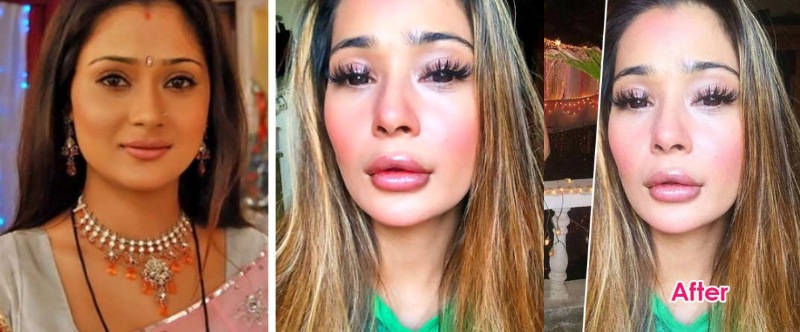 sara khan before and after