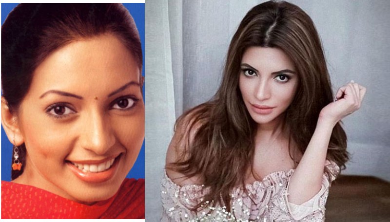 Shama sikander plastic surgery after