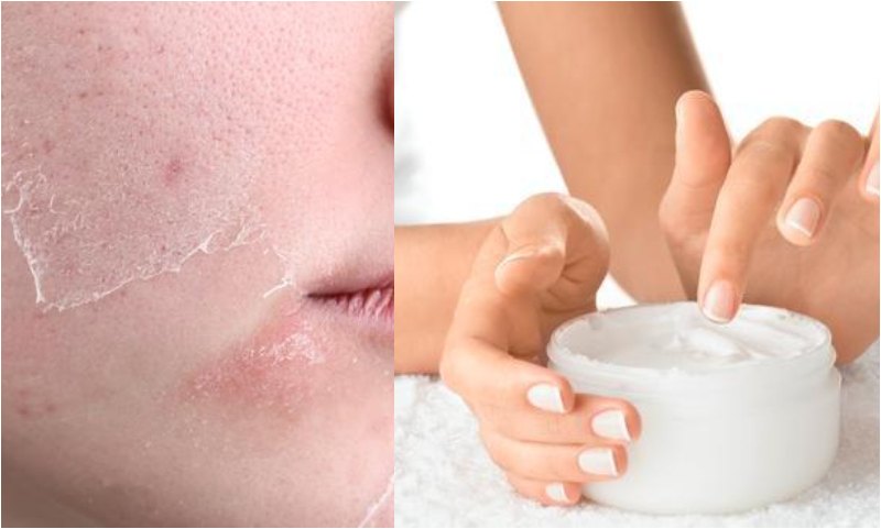 5 Amazing Skincare Hacks For Glowing Skin in Winters